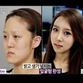 震驚! 南韓逆轉命運的整形 醜姐妹花大變身
