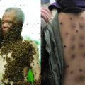 70歲阿公為了治腳自願讓１００隻蜜蜂狂螫，第一天以為「紅腫」是療效，結果連螫三次後他的下場嚇壞了所有人！