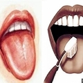 清舌苔能防癌，但不能用錯方法！刷牙時謹記「這幾招」讓你病痛不入口！