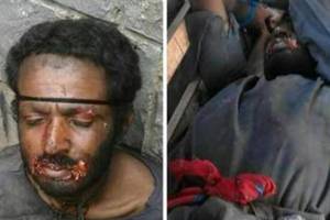 葉門出現狗殭屍，警察逮捕他的時候，他正抓起隨機抓來的小狗，發狠的生吸小狗的血…