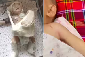 難產「扯斷男嬰手臂」媽崩潰 醫:不拉斷出不來 難產「扯斷男嬰手臂」媽崩潰 醫:不拉斷出不來