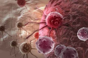 癌症自體免疫細胞療法 明年鬆綁!
