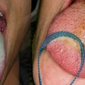 刷牙時到底該不該「刷舌苔」90%的人都弄錯了！你的「舌像」變這樣要趕快就醫！太可怕了....
