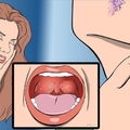 你的「喉嚨」常又乾又緊嗎？要特別小心了！！可能是這種「癌症」早期徵狀…
