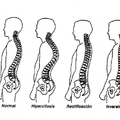 「脊椎」人一生的命根，若是歪了就不健康！這些方法我試了一週脊椎就挺了，百病不生、舒適許多！不妨試試看！
