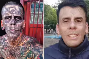 全身95%面積刺青!男為「找回尊嚴」忍痛3倍手術洗掉 重生模樣曝 全身95%面積刺青!男為「找回尊嚴」忍痛3倍手術洗掉 重生模樣曝