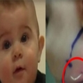 媽媽發現7個月大的寶寶臉頰上突然長了一根「白色尖角」！摸起來還硬硬的！送去醫院檢查...發現「真相」竟是...聽得她心臟差點停止！
