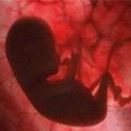 墮胎的嬰兒生出來如果還有呼吸，醫院竟然是這樣處理！
