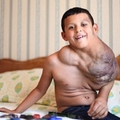 這名男孩的頸部天生就長了一個巨大的腫瘤，據醫生的說法，這就是所謂的OOO瘤，而這個疾病已經開始威脅他的生命...
