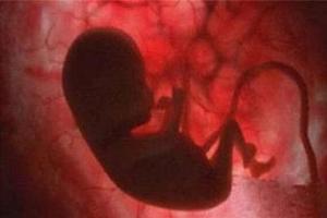 墮胎的嬰兒生出來如果還有呼吸，醫院竟然是這樣處理！