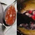 日本恐怖輻射製造出「恐怖核災鮭魚」全是白色增生組織跟腫瘤，容易引發這3種癌症！