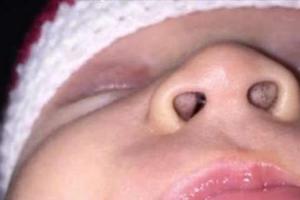 她發現小孩的鼻孔內長出了一些「微小的黑點」，這驚悚的成因讓她覺得不告訴大家不行！