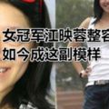 女冠軍江映蓉整容失敗，如今成這副模樣