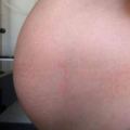 懷孕28周意外早產，醫生拿出孩子後，孩子一動作讓媽媽痛哭