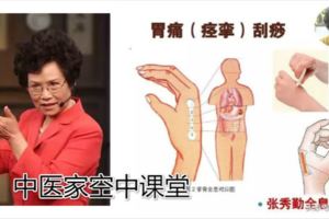 刮痧治療突發病、急症（下）｜中醫家空中課堂