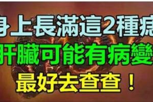 身上長滿這2種痣，要警惕肝臟是否有「病變」，最好去查查！