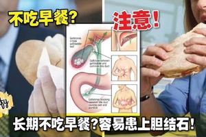 長期不吃早餐？容易患上膽結石！