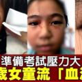 考前讀書壓力大　11歲女童竟流「血汗」