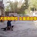 遭比特犬撲倒狠咬女童頭皮慘被掀開