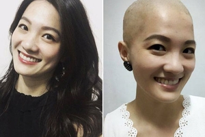 這位美女記者30歲得知罹患乳癌，但她卻毅然公開光頭照表示「永遠別放棄美麗的可能」！