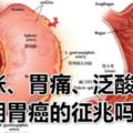 胃脹、胃痛、泛酸是早期胃癌的徵兆嗎？