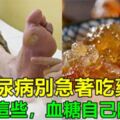 糖尿病人別急著吃藥，每天多吃這些食物，3個月，血糖自己慢慢降下來