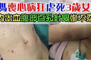 後媽喪心病狂虐死3歲女童，顱內出血腹部百孔針眼慘不忍睹