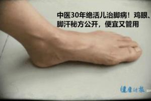 中醫30年絕活兒治腳病！雞眼、腳汗秘方公開，便宜又管用