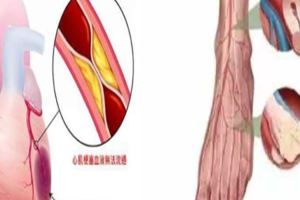 血管堵沒堵，一摸就知道，6個方法讓血管暢通無阻