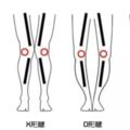 天生X/O/XO型腿？教你糾正腿型的針對性方法，還你一雙筆直長腿！