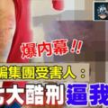 「７大酷刑逼我騙人!!」電話詐騙集團大馬女「同夥」，竟然也是受害人~~她身上傷痕累累觸目驚心……