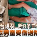 洗手台爆裂斷8條血管神經10歲男童受傷送院急救