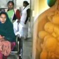懷上10胞胎的印度女子「在懷孕12週後早產」，沒想到所有胎兒竟然無一倖免！