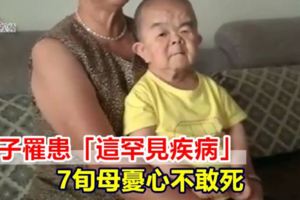 獨子罹患「這罕見疾病」7旬母憂心不敢死