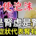 小便泡沫多，不是腎虛是腎衰！這些症狀代表腎有問題！