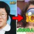 她從小被恥笑「蛞蝓腥臭女」決定砸錢整形，8個月後「術後模樣」卻讓網友痛罵：醫生整人！？