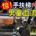 2019-04-28:沙登,驚！手扶梯「吃」腳6歲男童血流不止!!!(內附視頻）