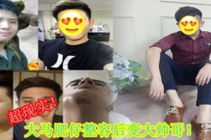 超現實！大馬肥仔整容後變大帥哥！