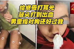 給繼母打耳光敲頭打到出血男童指對狗還好過我