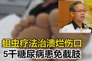 蛆蟲療法治潰爛傷口　5千糖尿病患免截肢