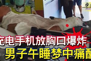 充電手機放胸口爆炸男子午睡夢中痛醒