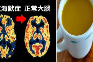 「失智」救星是它！每天兩杯降伏「阿茲海默症」、腦細胞全修復，這樣吃最有效