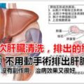 洗肝法，不用動手術也能排出肝膽結石不用動手術的肝髒清洗法