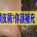 頭皮屑、鼻子出油竟也是缺少它？吃對維他命「早救命」！