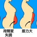 16種「不同體態隱藏著的健康狀況」　蘋果型身材內髒脂肪太多會有糖尿病