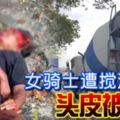 女騎士遭攪泥車撞頭皮被扯脫