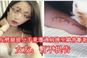 抓男友劈腿提分手竟遭過肩摔至鎖骨斷韌帶斷　女友：暫不提告