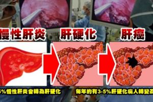 酒量突然變差、整天昏昏欲睡，這是肝給你的警告！肝最需要的7大營養一定要知道...