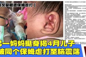 【10月女嬰疑遭保姆虐打】另一媽媽挺身揭4月兒子曾被同個保姆虐打至腦震蕩