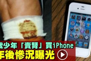 17歲少年「賣腎」買iPhone！7年後成傷殘人士！